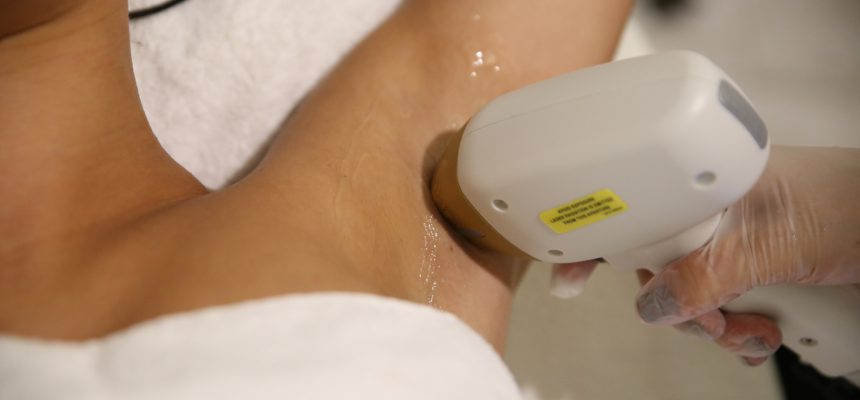 All about Soprano Ice Laser Hair Removal 